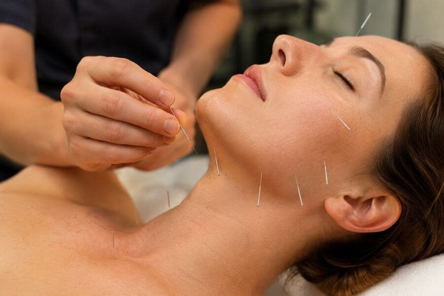 the acupuncturists